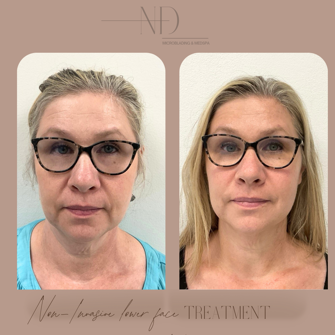 Before and after permanent makeup transformation